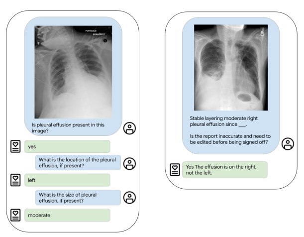 ELIXR: Towards a general purpose X-ray artificial intelligence system through alignment of large language models and radiology vision encoders